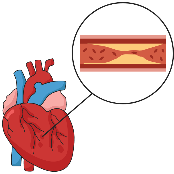 Cardiology