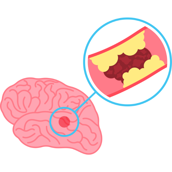 Cardiology