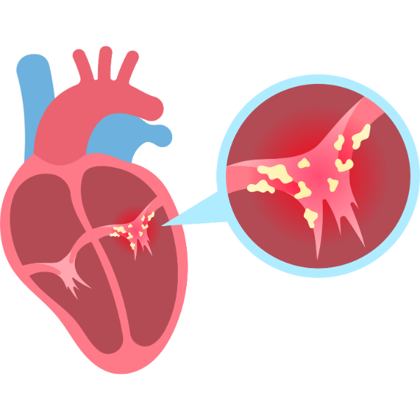 Cardiology