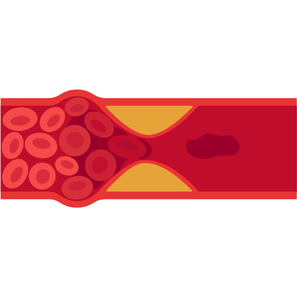 Cardiology