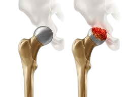 Cardiology
