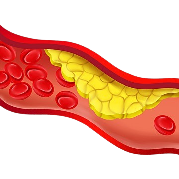 Cardiology