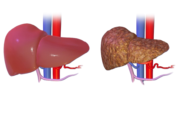 Cardiology