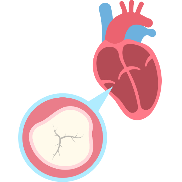 Cardiology